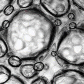 Bubbly yield-stress fluid